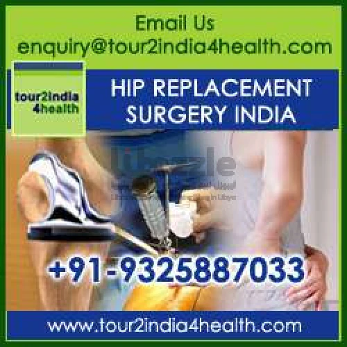 أفضل سعر لاستبدال الورك في الهند